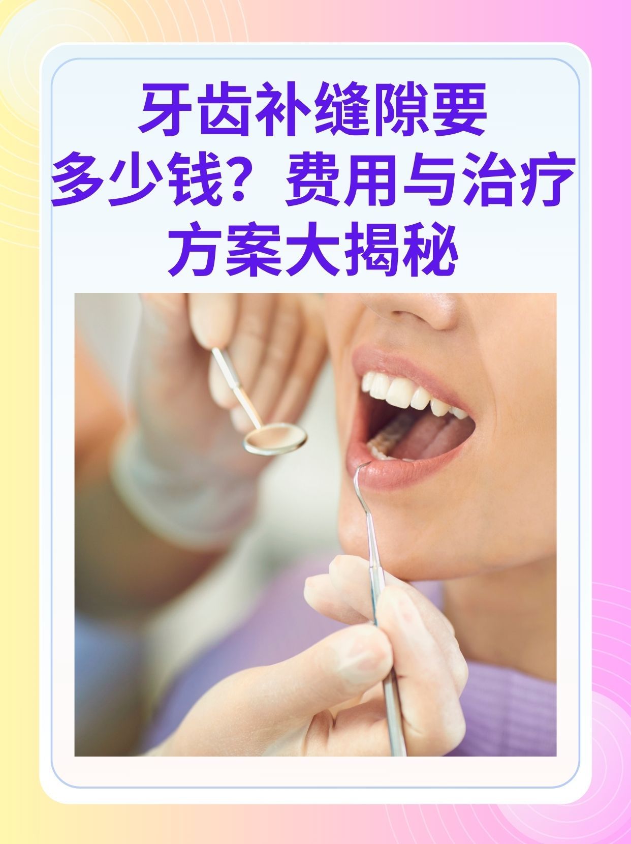 大连补牙医保可以报销吗(补牙医保可以报销吗 哪些可以报销呢)